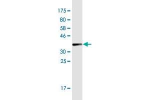 Western Blotting (WB) image for anti-Collagen, Type I, alpha 2 (COL1A2) (AA 1257-1366) antibody (ABIN947718)