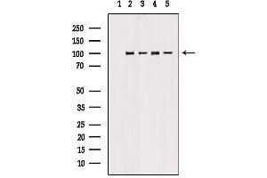Western Blotting (WB) image for anti-Proteasome (Prosome, Macropain) 26S Subunit, Non-ATPase, 2 (PSMD2) (C-Term) antibody (ABIN6264489)