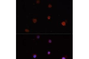 Immunofluorescence analysis of THP-1 cells using NLRC4 Polyclonal Antibody (NLRC4 抗体)