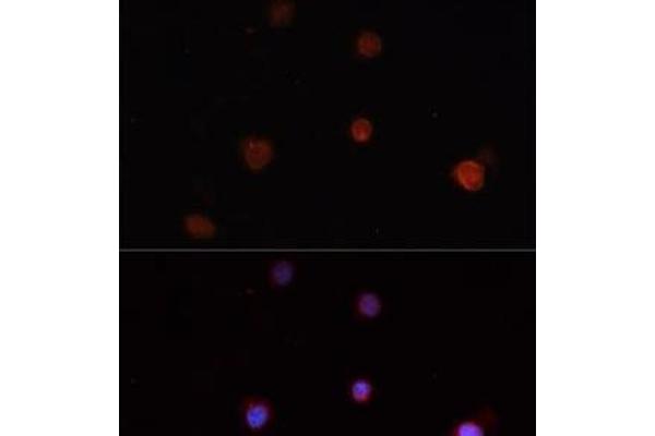 NLRC4 anticorps