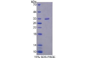 SDS-PAGE analysis of Mouse STK11 Protein. (LKB1 蛋白)