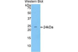 Western blot analysis of the recombinant protein. (TNNI1 抗体  (AA 1-187))