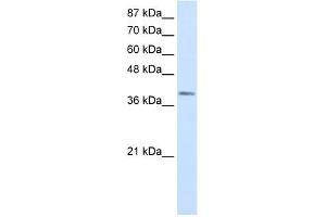 WB Suggested Anti-LMX1A Antibody Titration:  0. (LMX1A 抗体  (Middle Region))