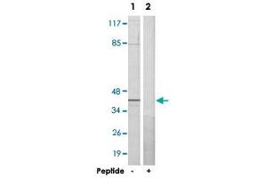 Western blot analysis of extracts from HeLa cells, using RBMX polyclonal antibody . (RBMX 抗体  (N-Term))