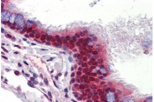 Human Lung, Respiratory Epithelium (formalin-fixed, paraffin-embedded) stained with UBQLN1 antibody ABIN462260 followed by biotinylated goat anti-rabbit IgG secondary antibody ABIN481713, alkaline phosphatase-streptavidin and chromogen. (Ubiquilin 1 抗体  (AA 290-339))