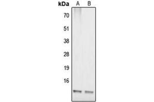 Western blot analysis of COX17 expression in IMR32 (A), HepG2 (B) whole cell lysates. (COX17 抗体  (N-Term))