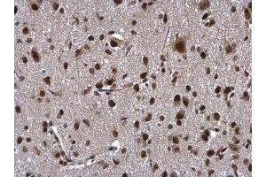 IHC-P Image ZNF346 antibody [N1C3] detects ZNF346 protein at cytoplasm and nucleus in rat brain by immunohistochemical analysis. (ZNF346 抗体)