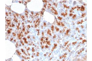 Formalin-fixed, paraffin-embedded human Pancreas stained with MDM2 Mouse Monoclonal Antibody (MDM2/2414). (MDM2 抗体  (AA 126-254))