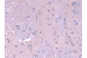 Immunohistochemistry (IHC) image for anti-Metal-Regulatory Transcription Factor 1 (MTF1) (AA 2-139) antibody (ABIN7444628)