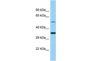 Western Blotting (WB) image for anti-Membrane Bound O-Acyltransferase Domain Containing 4 (MBOAT4) (C-Term) antibody (ABIN2444668) (MBOAT4 抗体  (C-Term))