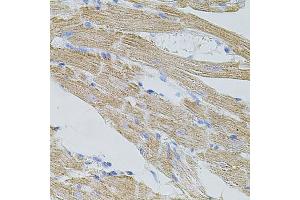 Immunohistochemistry of paraffin-embedded mouse heart using TRP antibody (ABIN6133559, ABIN6149565, ABIN6149567 and ABIN6224668) at dilution of 1:100 (40x lens). (TRPA1 抗体  (AA 850-950))
