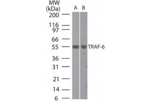 Western Blotting (WB) image for anti-TNF Receptor-Associated Factor 6 (TRAF6) (AA 436-449) antibody (ABIN208879) (TRAF6 抗体  (AA 436-449))