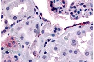 Human Glomerulus and Renal Tubular Epithelium in Cortex (formalin-fixed, paraffin-embedded) stained with ERBB4 antibody ABIN213400 at 15-32 ug/ml followed by biotinylated goat anti-rabbit IgG secondary antibody ABIN481713, alkaline phosphatase-streptavidin  . (ERBB4 抗体  (Internal Region))