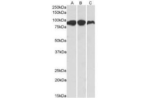 AP21267PU-N ACO2 Antibody staining of Human (A), Mouse (B) and Rat (C) Adipose lysates at 0. (ACO2 抗体  (Internal Region))