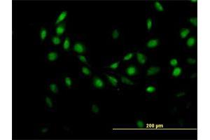 Immunofluorescence of purified MaxPab antibody to C7orf16 on HeLa cell. (G Substrate 抗体  (AA 1-155))