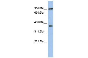 RSPH10B antibody used at 1 ug/ml to detect target protein. (RSPH10B 抗体)