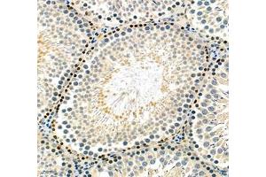 Immunohistochemistry (Paraffin-embedded Sections) (IHC (p)) image for anti-High Mobility Group Nucleosome Binding Domain 1 (HMGN1) antibody (ABIN7074222)