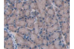 DAB staining on IHC-P; Samples: Rat Pancreas Tissue (GBA 抗体  (AA 248-508))