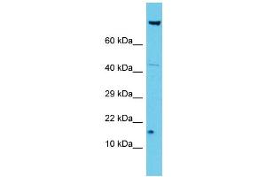 Host: Rabbit Target Name: NDUFA12 Sample Type: Jurkat Whole Cell lysates Antibody Dilution: 1. (NDUFA12 抗体  (N-Term))