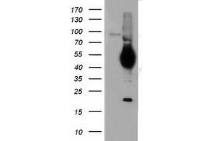 HEK293T cells were transfected with the pCMV6-ENTRY control (Left lane) or pCMV6-ENTRY CD5 (Right lane) cDNA for 48 hrs and lysed. (CD5 抗体)