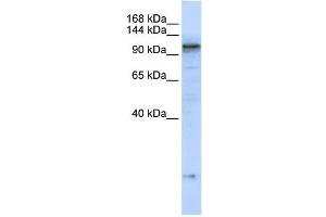 ATP2A2 antibody used at 1 ug/ml to detect target protein. (ATP2A2 抗体  (C-Term))