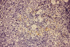Anti-GM-CSF Picoband antibody,  IHC(P): Mouse Spleen Tissue (GM-CSF 抗体  (AA 18-141))