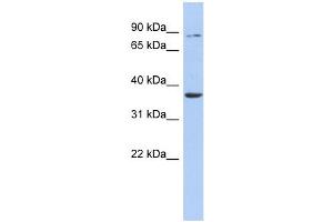 HS3ST1 antibody used at 1 ug/ml to detect target protein.