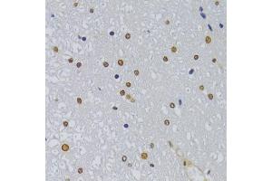 Immunohistochemistry of paraffin-embedded rat spinal cord using HNRNPA1 Antibody (ABIN5975570) at dilution of 1/100 (40x lens). (HNRNPA1 抗体)