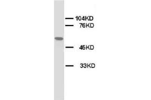 Western blot on Rat skeletal muscle lysis using AP23320PU-N CHRNA1 antibody. (CHRNA1 抗体  (N-Term, Subunit alpha))