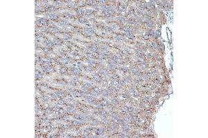 Immunohistochemistry of paraffin-embedded mouse liver using SR-B2/SR-B2/LIMPII Rabbit mAb (ABIN7270157) at dilution of 1:100 (40x lens). (SCARB2 抗体)