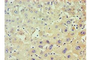 Immunohistochemistry of paraffin-embedded human liver tissue using ABIN7150482 at dilution of 1:100 (POLR1D 抗体  (AA 1-133))