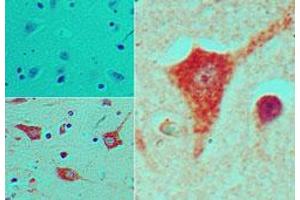 Image no. 1 for anti-NK2 Homeobox 5 (NKX2-5) (AA 300-324) antibody (ABIN960279) (NK2 Homeobox 5 抗体  (AA 300-324))