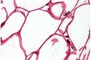 Human Adipocytes: Formalin-Fixed, Paraffin-Embedded (FFPE) (SHC1 抗体  (AA 171-280))
