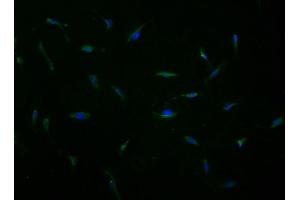 Immunofluorescence staining of U251 cells with ABIN7167254 at 1:100, counter-stained with DAPI. (RAB23 抗体  (AA 18-234))