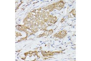 Immunohistochemistry (IHC) image for anti-Heat Shock 70kDa Protein 8 (HSPA8) (AA 1-300) antibody (ABIN3016124)