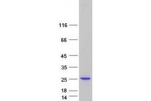 Western Blotting (WB) image for CGG Triplet Repeat Binding Protein 1 (CGGBP1) (Transcript Variant 1) protein (Myc-DYKDDDDK Tag) (ABIN2713945)