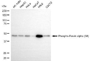 Western blotting analysis using phospho-parvin alpha (S8) antibody (ABIN7799739).