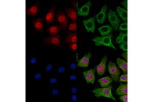 ABIN7094896 and ABIN7098949 staining HepG2 cells by IF/ICC. (SMC5 抗体  (C-Term))