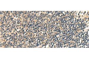 Immunohistochemistry of paraffin-embedded Human tonsil tissue using CNST Polyclonal Antibody at dilution of 1:60(x200) (CNST 抗体)