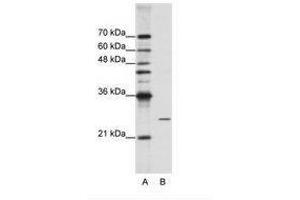 Image no. 2 for anti-Processing of Precursor 4, Ribonuclease P/MRP Subunit (POP4) (C-Term) antibody (ABIN202077) (RPP29 抗体  (C-Term))