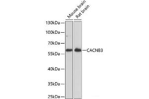 Western blot analysis of extracts of various cell lines using CACNB3 Polyclonal Antibody at dilution of 1:1000. (CACNB3 抗体)