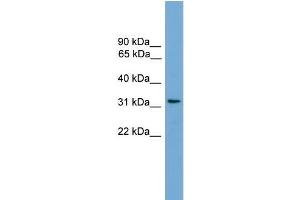 Human COLO205; WB Suggested Anti-CCDC117 Antibody Titration: 0. (CCDC117 抗体  (C-Term))