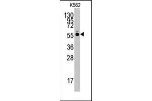 Western blot analysis of anti-HARS Pab in K562 cell line lysates (35ug/lane). (HARS1/Jo-1 抗体  (N-Term))