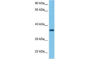 Western Blotting (WB) image for anti-Asialoglycoprotein Receptor 1 (ASGR1) (Middle Region) antibody (ABIN2778131)