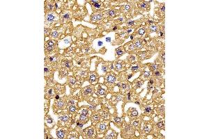 Immunohistochemical analysis of paraffin-embedded M. (HBG2 抗体  (C-Term))