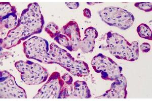 Human Placenta: Formalin-Fixed, Paraffin-Embedded (FFPE) (ADAM12 抗体  (AA 2-14))