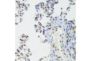 Immunohistochemistry of paraffin-embedded mouse lung using BAZ1B antibody. (BAZ1B 抗体  (AA 1-260))