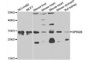 Western blot analysis of extracts of various cell lines, using SPIN2B antibody. (Spindlin 2B 抗体)