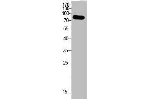 Western Blot analysis of HepG2 cells using Acetyl-Ub (K29) Polyclonal Antibody (UBA52/RPS27A/UBB/UBC (acLys29) 抗体)