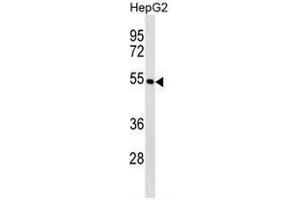 KRT26 Antibody (N-term) western blot analysis in HepG2 cell line lysates (35µg/lane). (Keratin 26 抗体  (N-Term))